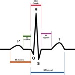 how to read an ekg