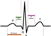 how to read an ekg